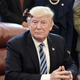 Image for article titled Calm, Measured Trump Hard At Work After Freak Accident Leaves Him With Railroad Spike Lodged In Skull